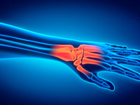 7 упражнений для укрепления рук, запястий и предплечий