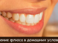 Чем лечить флюс на десне в домашних условиях: 18 подручных средств от флюса